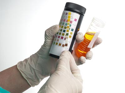 L'examen des urines par bandelette urinaire réactive - Pratique infirmière