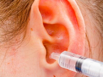 Comment nettoyer une oreille bouchée ?
